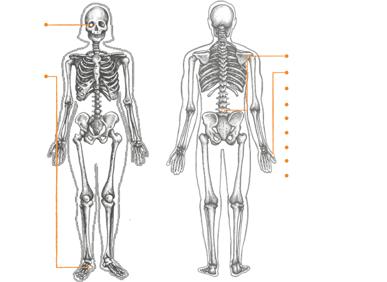 A Diagram of the SpA Features Shown on the Human Body